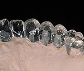 歯型の模型（ステント）